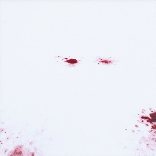 Krv na snegu: Warn na nagli prekid porodičnog mira